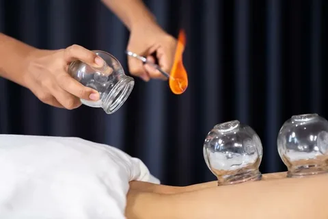 Chinese Fire Cupping: A Traditional Healing Practice for Modern Times